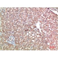 TTR Mouse Monoclonal Antibody3B5