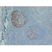 Topoisomerase IIa, CONFIRM Monoclonal Antibody PT0247