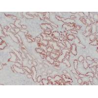 pVHL Mouse Monoclonal AntibodyPT0230