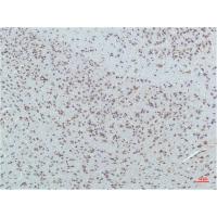 PPAR Delta Mouse Monoclonal Antibody1D7