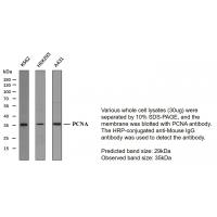 Proliferating Cell Nuclear Antigen PCNA 3F2 mouse Monoclonal Antibody