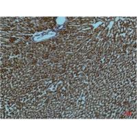 PI3 Kinase P85α Monoclonal Antibody2D2