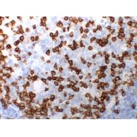 PD-1 AS1A13 mouse Monoclonal Antibody