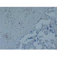 p57kip2 Monoclonal Antibody PT0206