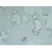 p63 1C2 mouse Monoclonal Antibody