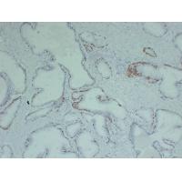 p63 1C2 mouse Monoclonal Antibody