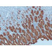 MUC5AC Monoclonal Antibody PT0176