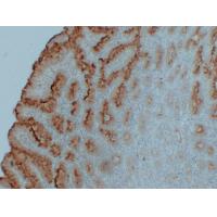 MUC5AC Monoclonal Antibody PT0176