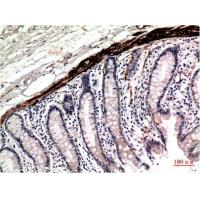 Muscle actin Mouse Monoclonal Antibody2H3