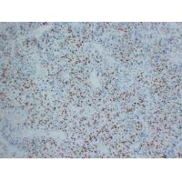 Myogenin Mouse Monoclonal AntibodyPT0193