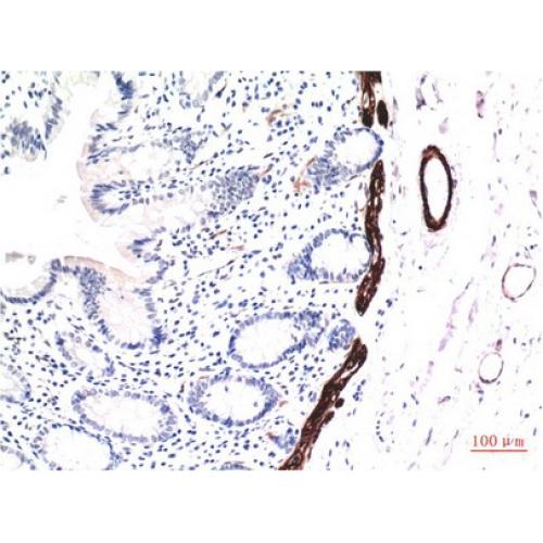 Muscle actin Mouse Monoclonal Antibody1E9