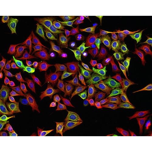 PC-9/Ponatinib 人肺癌细胞 耐药