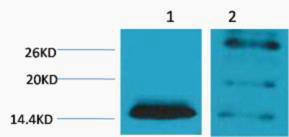 Histone H2B Di Methyl Lys5 Polyclonal Antibody