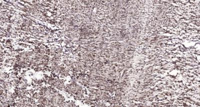 Acetyl P53K382 Mouse Monoclonal Antibody15F4