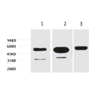 β-tubulin Monoclonal Antibody