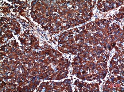 AKT Mouse Monoclonal Antibody1H2