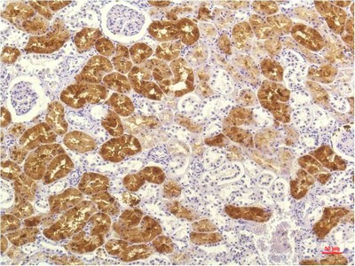 IL-8 Mouse Monoclonal Antibody8B1