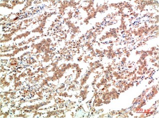 JAK2 Mouse Monoclonal Antibody3F10