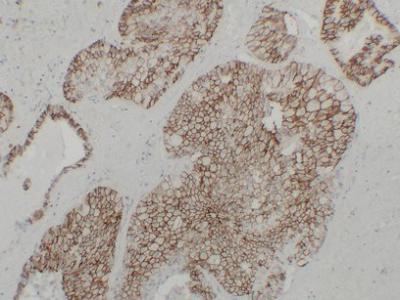 KSP-Cadherin Monoclonal Antibody PT0161