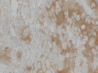 Collagen Type II Monoclonal Antibody PT0115