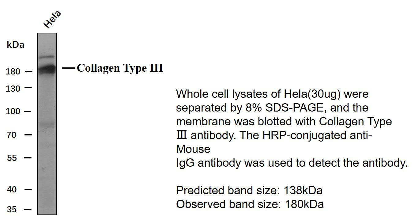 Collagen Type III Monoclonal Antibody PT0117