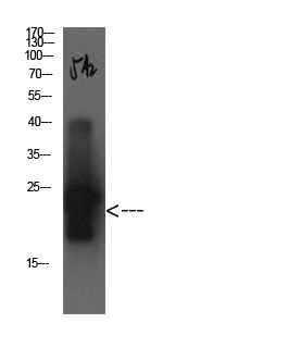 Cystatin C Mouse Monoclonal Antibody5A2