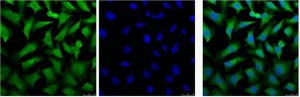 Cytokeratin 18 Monoclonal Antibody1B3