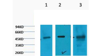 Cytokeratin 18 Monoclonal Antibody2F7