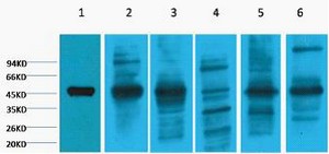 Cytokeratin 18 Monoclonal Antibody8F2