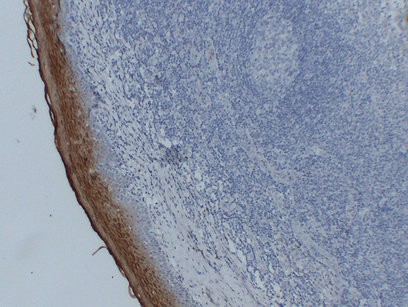 Annexin A1 1B1 mouse Monoclonal Antibody