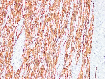 Desmin Monoclonal Antibody PT0121