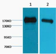 EGFR Monoclonal AntibodyM6