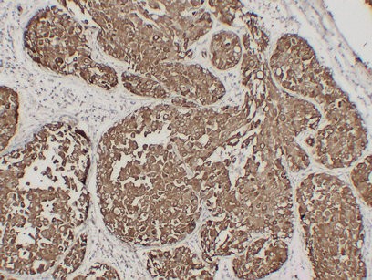 EMA CA 15.3, MUC1 7G1 mouse Monoclonal Antibody