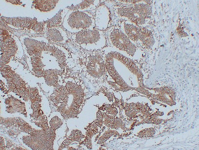 EpCAM AS1A15 mouse Monoclonal Antibody