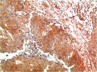 ATG5 Mouse Monoclonal Antibody8B4