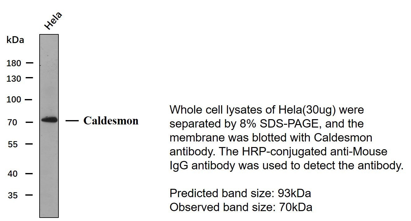 Caldesmon 1C1 mouse Monoclonal Antibody