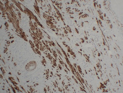 Calponin-1 1D1 mouse Monoclonal Antibody