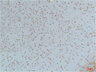 CaMKIIβ/γ/δ Phospho Thr287 Monoclonal Antibody4H2