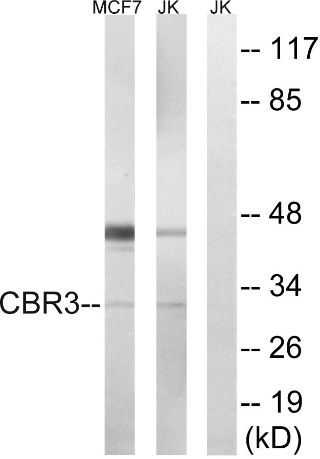 Carcinoembryonic Antigen Monoclonal Antibody10E1