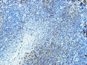 CD20 Monoclonal Antibody2F4