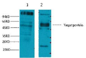 CD23 Monoclonal Antibody10H2