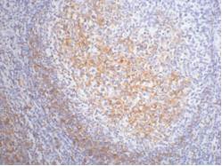 CD23 Monoclonal Antibody1E9