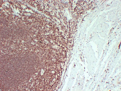 CD45 2F1 mouse Monoclonal Antibody