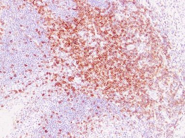 CD5 2G1 mouse Monoclonal Antibody