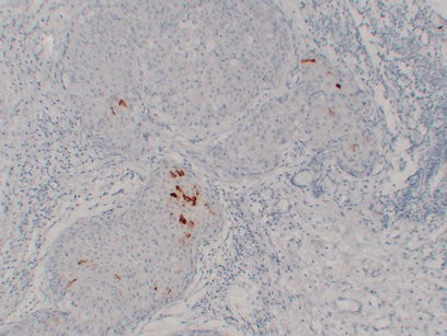 Mammaglobin A+B Monoclonal Antibody PT0163