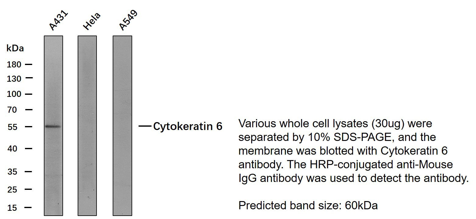 CK-6 Monoclonal Antibody PT0091