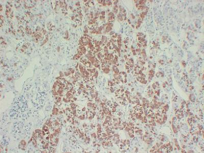 Growth HormoneGH Monoclonal Antibody PT0148