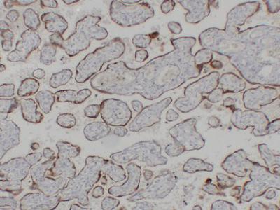 hCG β Monoclonal Antibody PT0149