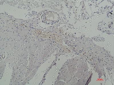 Galectin-3 Monoclonal Antibody2F9