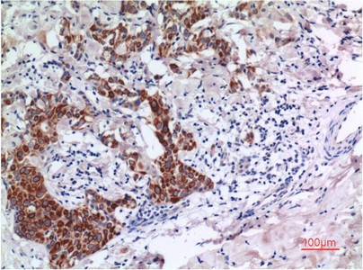 Smad3 Mouse Monoclonal Antibody1E8